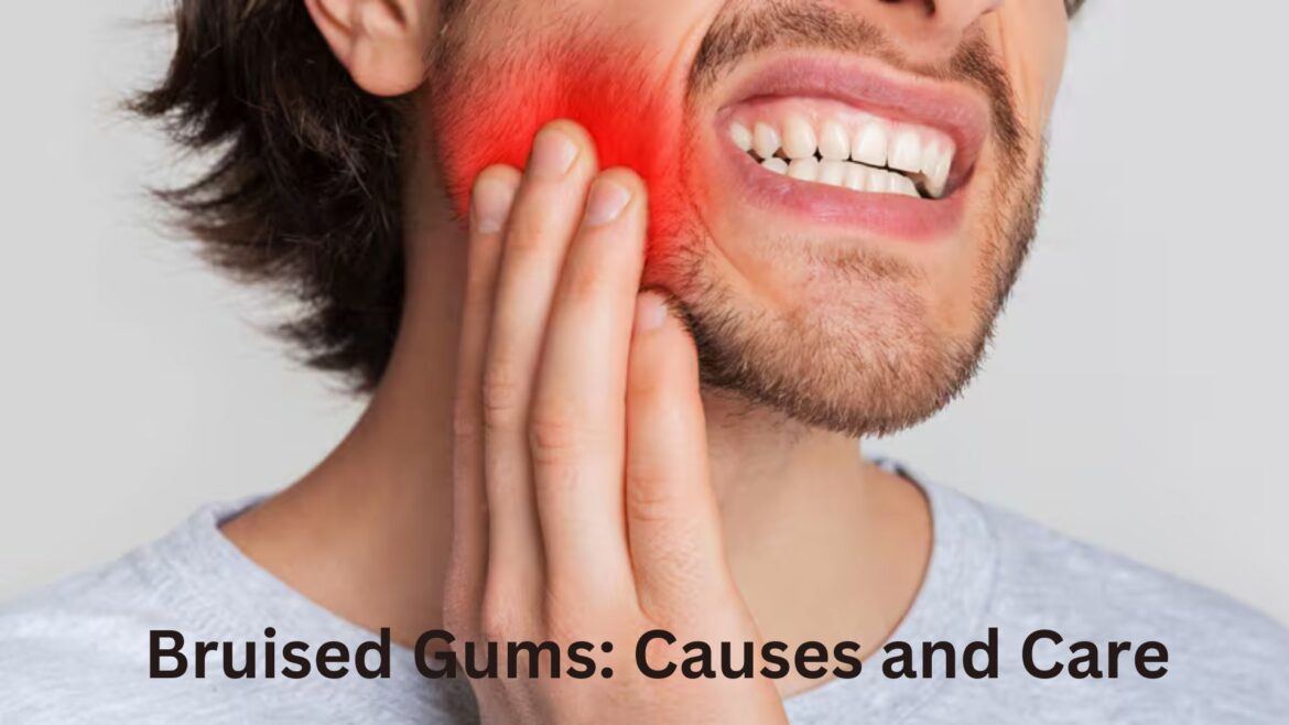 Bruised Gums: Causes and Care